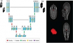 딥러닝 이용 자기공명영상 기반 뇌하수체 자동분할 모델 개발