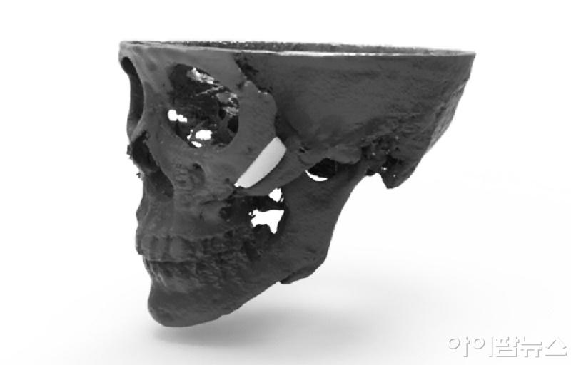 시지바이오 3D 프린팅 독자 기술로 환자 맞춤형 얼굴 재건.jpg
